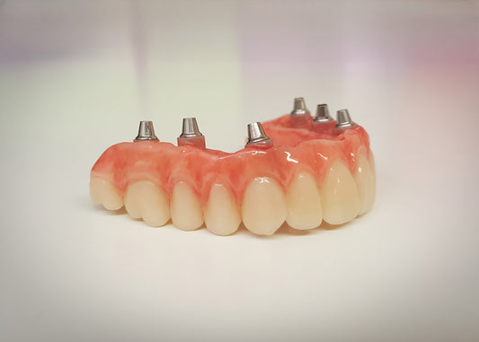 All on Six Implant Denture PMMA
